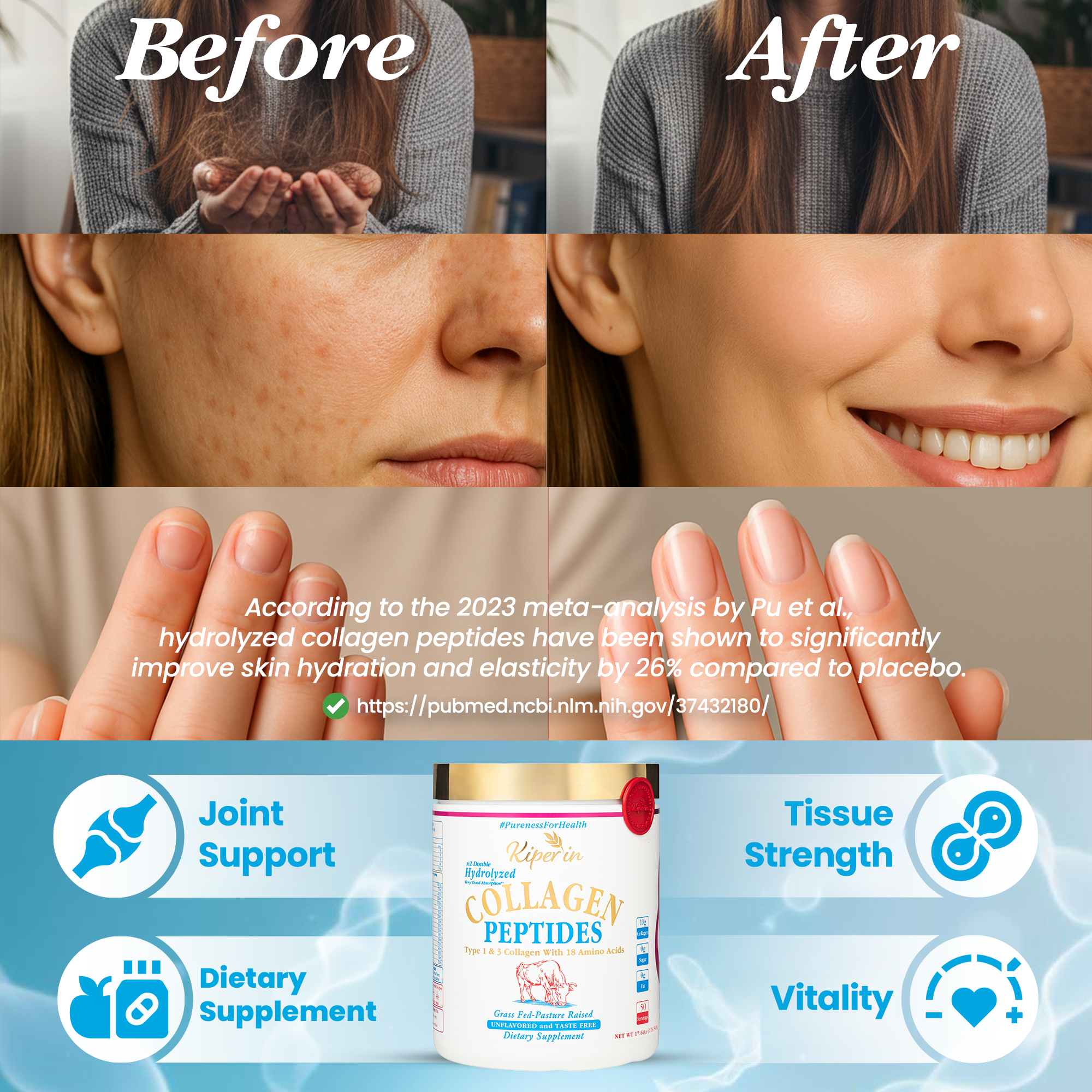 Kiperin Collagen Classic (500gr) 100% Pure and Natural High Bioactive Double Hydrolyzed Collagen Peptides Containing Supplementary Food